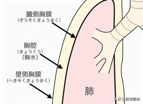 耳珠 胸水分析公式